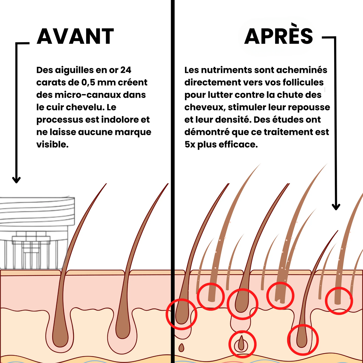 Leralia™ Système de Repousse Capillaire